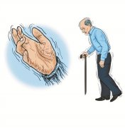 ����ɭ��ʲôԭ�������